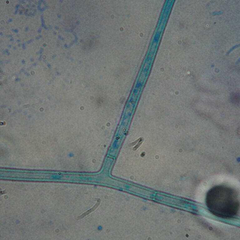 Thanatephorus cucumeris