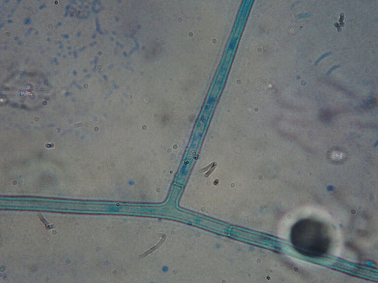 Thanatephorus cucumeris